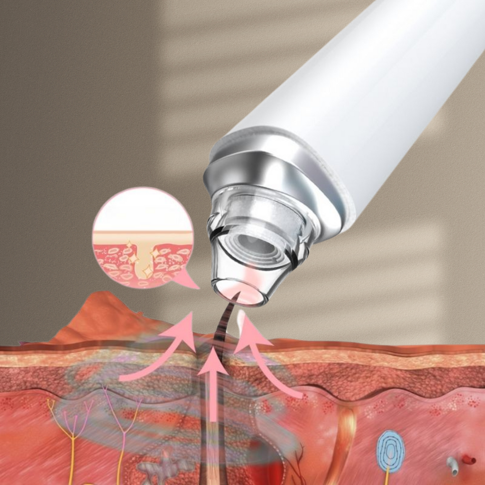 Smart Pore Detox Pro™ | Tiefenreinigung mit Kamerapräzision