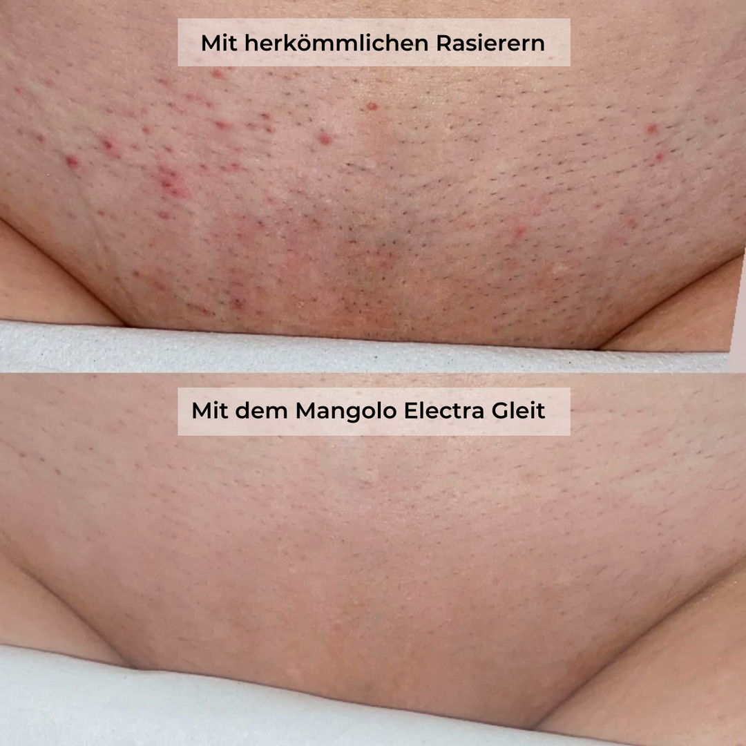 Mangolo Electra Gleit® | All-in-One Damenrasierer