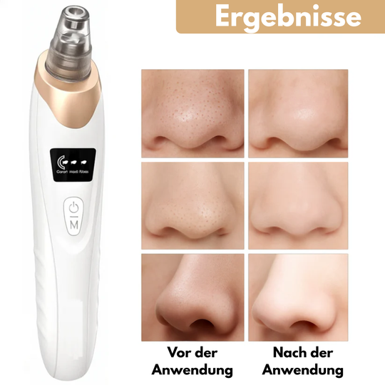 PorenRein Pro™ | Tiefenreinigung für eine strahlende Haut