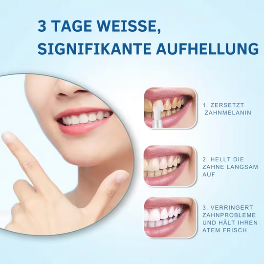 PerfectSmile™ Zahnaufhellungsstift: Für ein strahlendes Lächeln